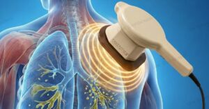 การสั่นของเครื่องสั่นปอด