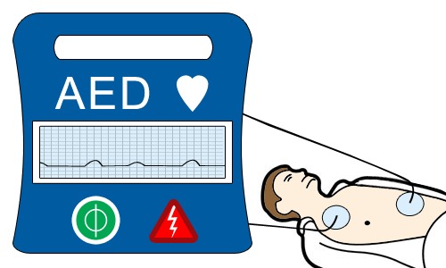 การจ่ายพลังงานไฟฟ้า (Joule Output)