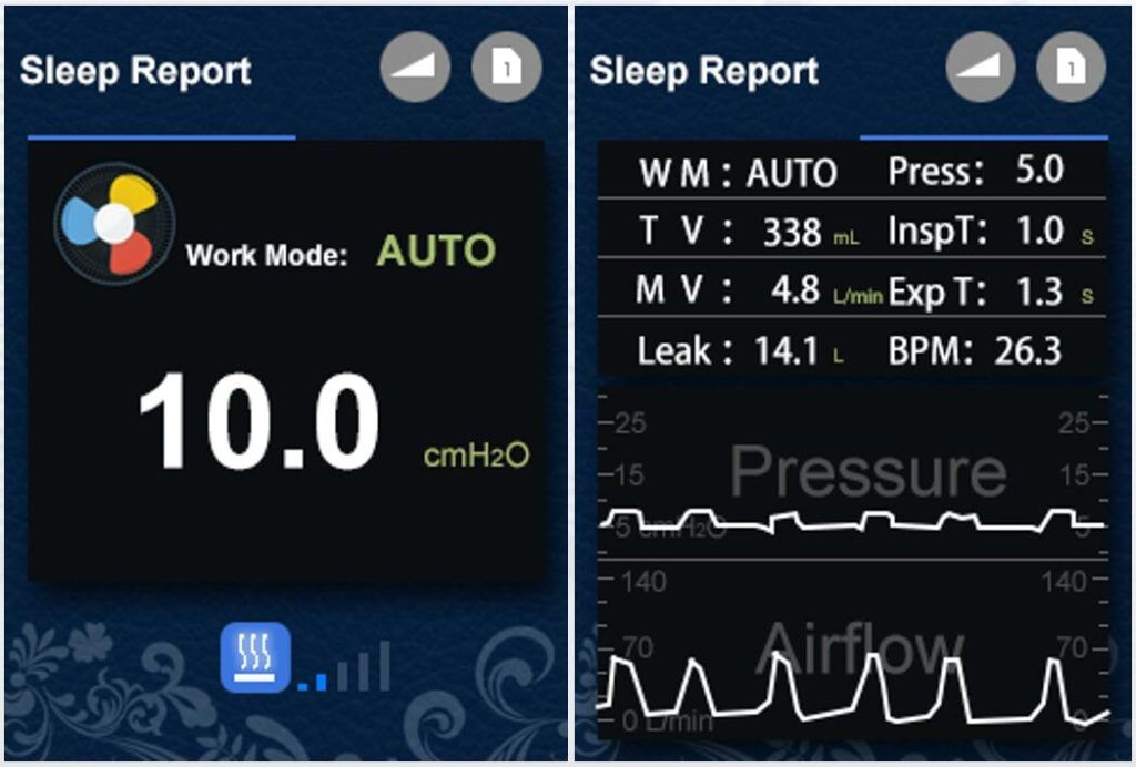หน้าจอแสดงผล เครื่อง CPAP