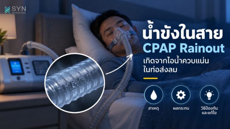 น้ำขังในสาย CPAP Rainout เกิดจากไอน้ำควบแน่นในท่อส่งลม