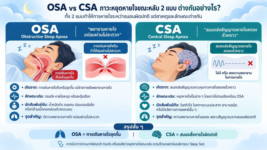 ภาพเปรียบเทียบ OSA และ CSA ภาวะหยุดหายใจขณะหลับสองแบบ